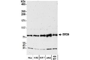 Western Blotting (WB) image for anti-Bromodomain Containing 9 (BRD9) (AA 547-597) antibody (ABIN7450043)