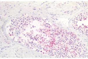 Detection of TAT1 in Human Testis Tissue using Polyclonal Antibody to Testis Anion Transporter 1 (TAT1) (SLC26A8 Antikörper  (AA 664-970))