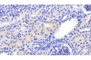 Detection of Cys-C in Porcine Kidney Tissue using Polyclonal Antibody to Cystatin C (Cys-C) (CST3 Antikörper  (AA 42-127))