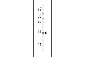 TCL6 Antibody (C-term) (ABIN654803 and ABIN2844478) western blot analysis in HL-60 cell line lysates (35 μg/lane). (TCL6 Antikörper  (C-Term))