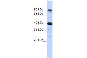 WB Suggested Anti-CARS Antibody Titration:  0. (CARS Antikörper  (Middle Region))