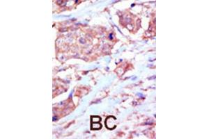 Immunohistochemistry (IHC) image for anti-EPH Receptor B6 (EPHB6) antibody (ABIN3003353) (EPH Receptor B6 Antikörper)