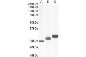 Western Blotting (WB) image for anti-Casein Kinase 2, beta (CSNK2B) antibody (ABIN5886333) (CSNK2B Antikörper)