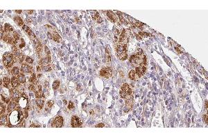 Immunohistochemistry (IHC) image for anti-Cholinergic Receptor, Nicotinic, gamma (CHRNG) (N-Term) antibody (ABIN6260828)