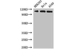 Western Blot Positive WB detected in: HEK293 whole cell lysate, Hela whole cell lysate, A549 whole cell lysate All lanes: IPO13 antibody at 3 μg/mL Secondary Goat polyclonal to rabbit IgG at 1/50000 dilution Predicted band size: 109 kDa Observed band size: 109 kDa (IPO13 Antikörper  (AA 501-700))