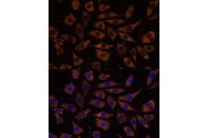 Immunofluorescence analysis of L929 cells using EIF5B antibody (ABIN7267052) at dilution of 1:100. (EIF5B Antikörper  (AA 1-273))