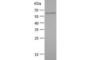 Western Blotting (WB) image for Heat Shock Protein 90kDa alpha (Cytosolic), Class A Member 1 (HSP90AA1) (AA 381-732) protein (His-IF2DI Tag) (ABIN7123278) (HSP90AA1 Protein (AA 381-732) (His-IF2DI Tag))