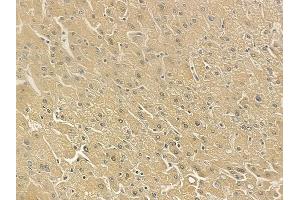 ABIN6262960 and ABIN6273263 at 1/100 staining human normal liver tissue by IHC-P. (EIF2D Antikörper  (Internal Region))