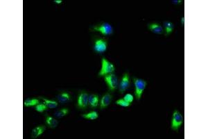 Immunofluorescence staining of Hela cells with ABIN7153319 at 1:66, counter-stained with DAPI. (G Protein-Coupled Receptor 12 Antikörper  (AA 1-48))