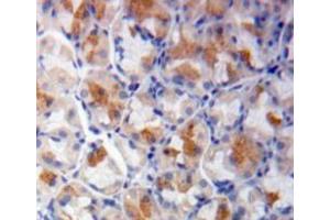Used in DAB staining on fromalin fixed paraffin-embedded stomach tissue (SHC1 Antikörper  (AA 272-559))