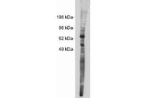 Image no. 1 for anti-Netrin 1 (NTN1) antibody (ABIN265184) (Netrin 1 Antikörper)