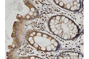 Immunohistochemistry (Formalin-fixed Paraffin-embedded Sections) (IHC (fp)) image for anti-Tubulin, beta 2A (TUBB2A) (AA 1-445) antibody (ABIN521149)