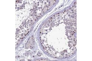 Immunohistochemical staining of human testis with DNTTIP2 polyclonal antibody  shows moderate nuclear and cytoplasmic positivity in subsets of cells in seminiferus ducts. (DNTTIP2 Antikörper)