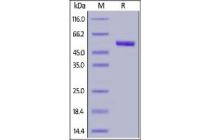 SDS-PAGE (SDS) image for Thymic Stromal Lymphopoietin (TSLP) (AA 29-159) (Active) protein (Fc Tag) (ABIN6950978)