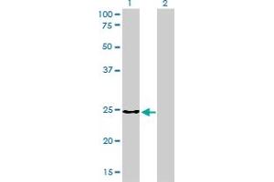 Western Blotting (WB) image for anti-Clathrin, Light Chain B (CLTB) (AA 1-212) antibody (ABIN598618) (CLTB Antikörper  (AA 1-212))