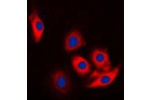 Immunofluorescent analysis of c-CBL (pY774) staining in Jurkat cells. (CBL Antikörper  (C-Term, pTyr774))
