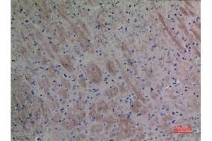 Immunohistochemistry (IHC) analysis of paraffin-embedded Mouse Brain, antibody was diluted at 1:100. (CCL26 Antikörper  (Internal Region))