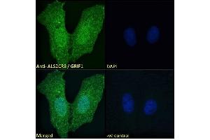ABIN184943 Immunofluorescence analysis of paraformaldehyde fixed U2OS cells, permeabilized with 0. (TRAK2 Antikörper  (C-Term))