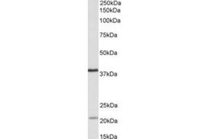 AP31770PU-N KLHDC8B antibody staining of Daudi lysate at 0. (KLHDC8B Antikörper  (Internal Region))