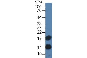 Detection of SAA in Human Serum using Monoclonal Antibody to Serum Amyloid A (SAA) (SAA Antikörper  (AA 19-122))