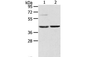 Western Blot analysis of Mouse brain and liver tissue using HIF1AN Polyclonal Antibody at dilution of 1:200 (HIF1AN Antikörper)