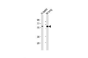 Western Blot at 1:2000 dilution Lane 1: human testis lysate Lane 2: mouse lung lysate Lysates/proteins at 20 ug per lane. (TGFBR2 Antikörper  (N-Term))