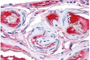 Human Small Intestine, Vessels (formalin-fixed, paraffin-embedded) stained with F12 antibody ABIN337368 at 5 ug/ml followed by biotinylated anti-goat IgG secondary antibody ABIN481715, alkaline phosphatase-streptavidin and chromogen. (F12 Antikörper)