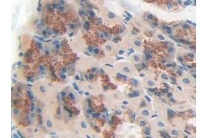 Immunohistochemistry (IHC) image for anti-Protein tyrosine Phosphatase, Receptor Type, J (PTPRJ) (AA 567-842) antibody (ABIN7441778)