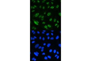 IF analysis of MSH2 using anti-MSH2 antibody (ABIN3043885).