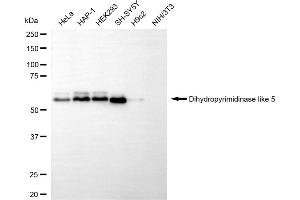 Western blotting analysis using dihydropyrimidinase like 5 antibody (ABIN7798340). (DPYSL5 Antikörper)
