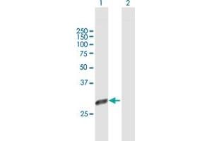 Western Blot analysis of PSMD9 expression in transfected 293T cell line by PSMD9 MaxPab polyclonal antibody. (PSMD9 Antikörper  (AA 1-223))