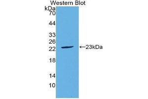 Western Blotting (WB) image for anti-Fibroblast Growth Factor 21 (FGF21) (AA 29-209) antibody (ABIN1867952) (FGF21 Antikörper  (AA 29-209))