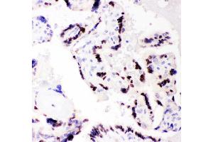 Anti- CEBP Beta Picoband antibody, IHC(P) IHC(P): Human Placenta Tissue (CEBPB Antikörper  (AA 1-200))