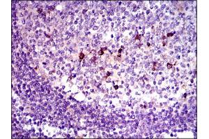 Image no. 1 for anti-Transforming Growth Factor, beta 1 (TGFB1) antibody (ABIN1491617) (TGFB1 Antikörper)
