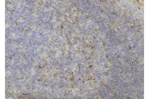 ABIN6273689 at 1/100 staining Human lymph node tissue by IHC-P.