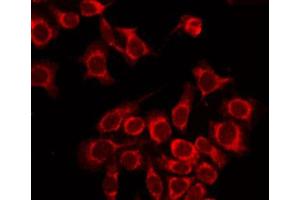 Immunofluorescence (fixed cells) (IF/ICC) image for anti-Calcium-Sensing Receptor (CASR) (pThr888) antibody (ABIN6255749)