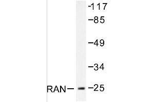 Image no. 1 for anti-RAN, Member RAS Oncogene Family (RAN) antibody (ABIN271799) (RAN Antikörper)