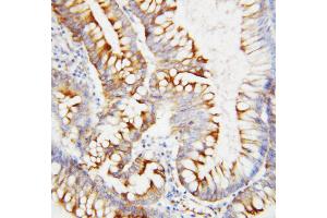 Immunohistochemistry (IHC) image for anti-Secreted Protein, Acidic, Cysteine-Rich (Osteonectin) (SPARC) (AA 284-303), (C-Term) antibody (ABIN3044449)