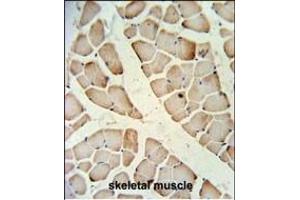 Immunohistochemistry (Paraffin-embedded Sections) (IHC (p)) image for anti-Hemochromatosis Type 2 (Juvenile) (HFE2) (AA 134-162) antibody (ABIN653653)