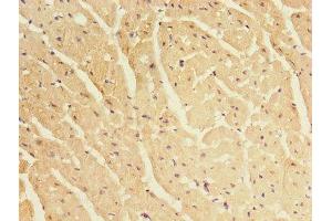 Immunohistochemistry of paraffin-embedded human heart tissue using ABIN7145462 at dilution of 1:100 (CRYBA1 Antikörper  (AA 1-215))