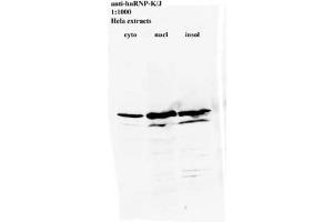 Image no. 2 for anti-Heterogeneous Nuclear Ribonucleoprotein K (HNRNPK) antibody (ABIN108575) (HNRNPK Antikörper)