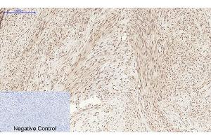 Immunohistochemical analysis of paraffin-embedded human uterus tissue.