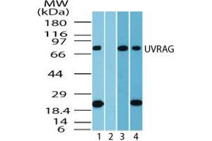 Image no. 1 for anti-UV Radiation Resistance Associated Gene (UVRAG) (AA 375-425) antibody (ABIN960401) (UVRAG Antikörper  (AA 375-425))