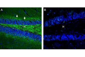 Expression of Neurofascin in mouse hippocampus. (NFASC Antikörper  (C-Term, Intracellular))