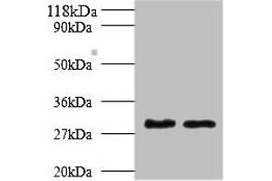 Western blot All lanes: Tpsb2 antibody at 2 μg/mL Lane 1: Mouse heart tissue Lane 2: Rat heart tissue Secondary Goat polyclonal to rabbit IgG at 1/10000 dilution Predicted band size: 31, 26 kDa Observed band size: 31 kDa (TPSB2 Antikörper  (AA 32-276))