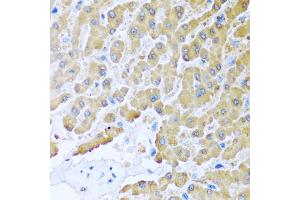 Immunohistochemistry of paraffin-embedded human liver using CCL8 antibody (ABIN5975074) at dilution of 1/100 (40x lens). (CCL8 Antikörper)