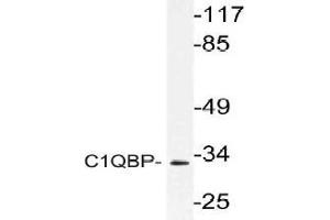 Western blot (WB) analysis of C1QBP antibody in extracts from Jurkat cells. (C1QBP Antikörper)