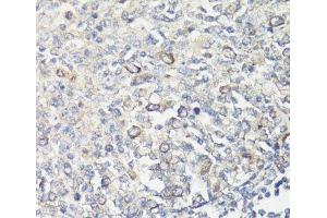 Immunohistochemistry of paraffin-embedded Human tonsil using MUL1 Polyclonal Antibody at dilution of 1:100 (40x lens). (MUL1 Antikörper)