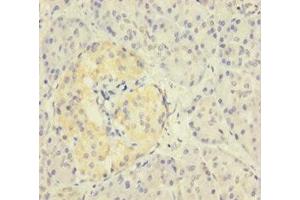 Immunohistochemistry of paraffin-embedded human pancreatic tissue using ABIN7176105 at dilution of 1:100 (ZNF114 Antikörper  (AA 1-414))