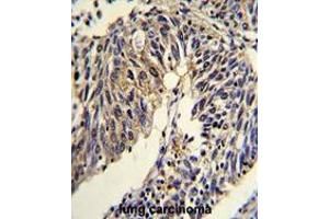 Immunohistochemistry (Paraffin-embedded Sections) (IHC (p)) image for anti-Tumor Necrosis Factor Receptor Superfamily, Member 14 (TNFRSF14) (AA 216-245), (Middle Region) antibody (ABIN955275)